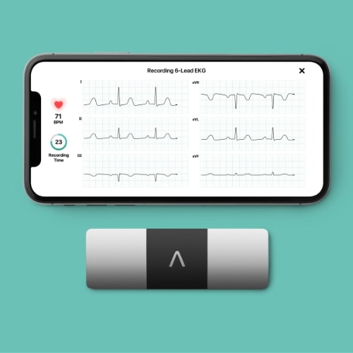 Kardia Mobile 6L (ECG)